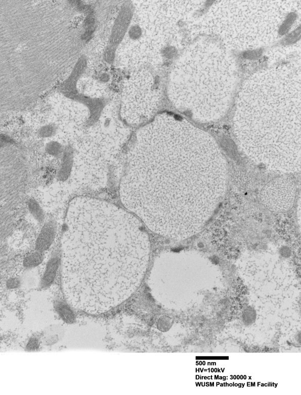 5D14 Muscle (Case 5) EM027 - Copy