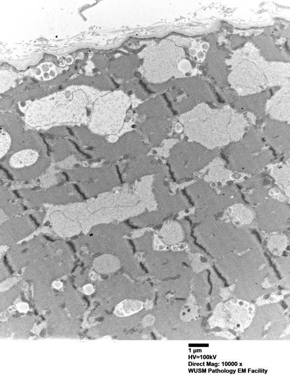 5D2 Muscle (Case 5) EM006 - Copy