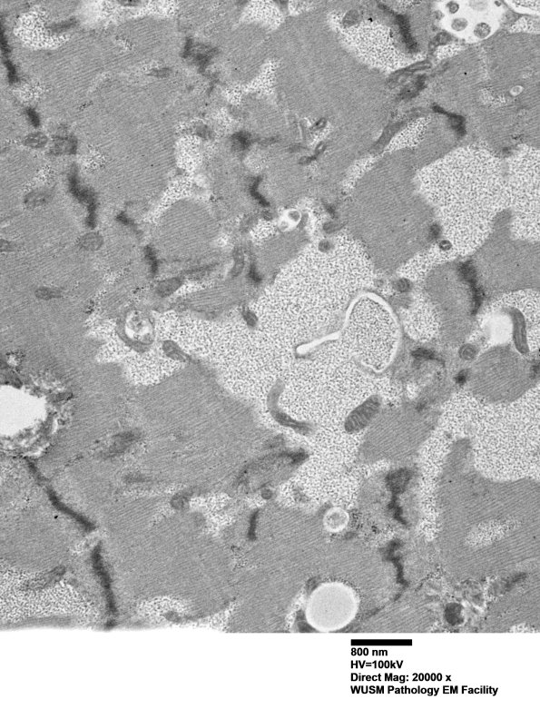 5D3 Muscle (Case 5) EM002 - Copy