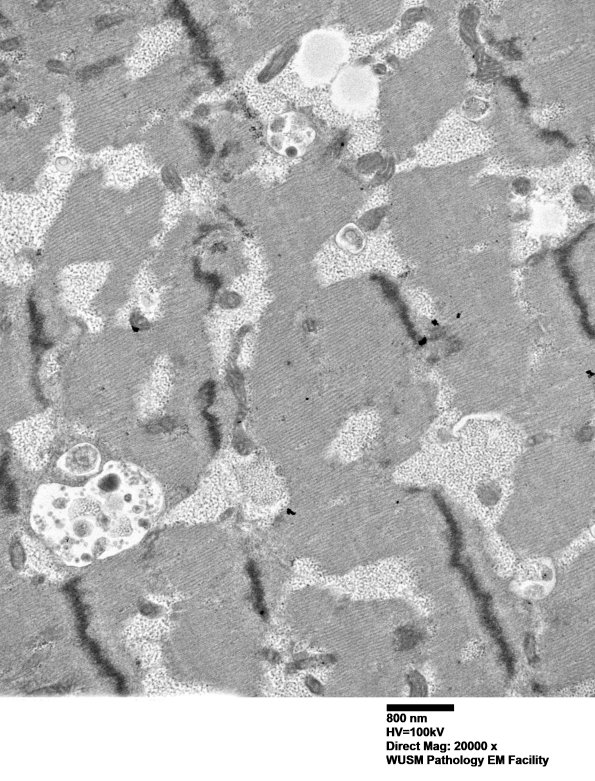 5D4 Muscle (Case 5) EM001 - Copy