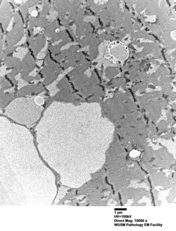 5D5 Muscle (Case 5) EM005 - Copy