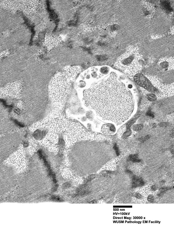 5D6 Muscle (Case 5) EM004 - Copy