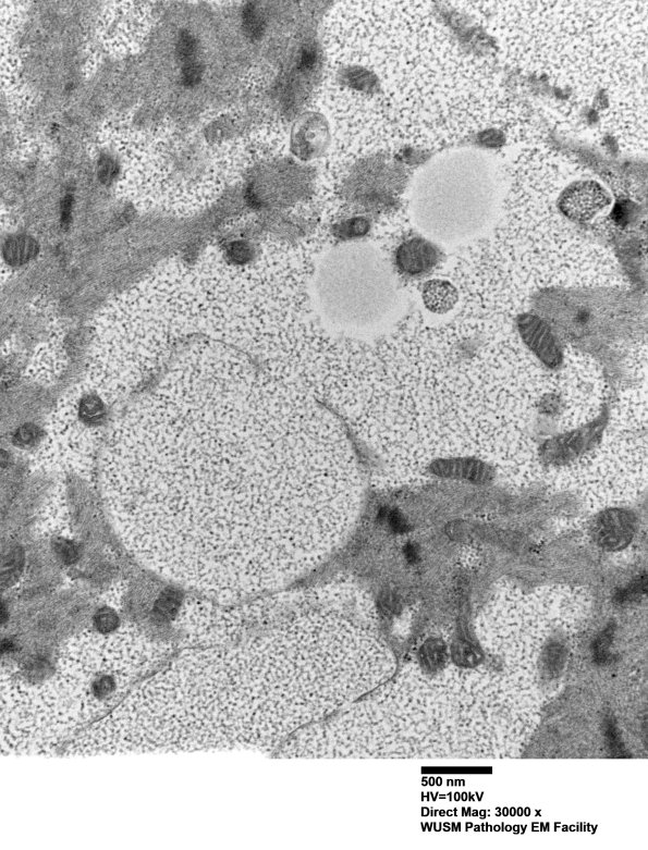 5D8 Muscle (Case 5) EM018 - Copy