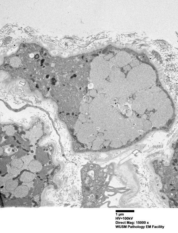 5D9 Muscle (Case 5) EM020 - Copy