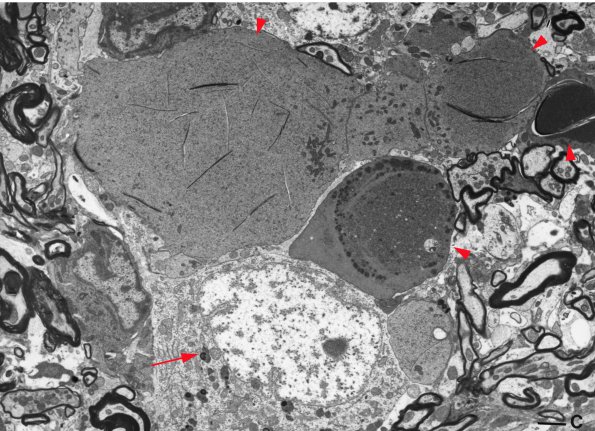 1B2 Aged Rat Gracile NAD IGF NT3 Paper copy