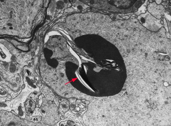 1B3 Aged Rat Gracile NAD IGF NT3 Paper 2 copy