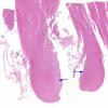 3A1 Wernicke's & Hypoxia-Ischemia (Case 3) H&E whole mount copy