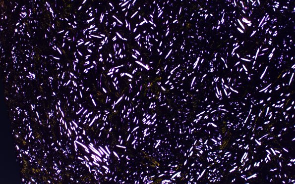 7A3 Gossypiboma, textiloma (Case 7) H&E 4X (polarized) 1