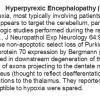 0A Hyperpyrexic Encephalopathy - Text