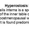 0A Hyperostosis frontalis Interna