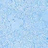 4H1 Granulomatous Hypophysitis (Case 4) A3 AFB 40X 2