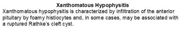 0A Hypophysitis - Xanthomatous