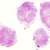 1J Neurosarcoidosis (Case 1) N10 H&E whole mount