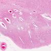 2B2B LGN, (Case 2) N21 2X 2