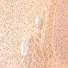 2F3C (Case 2) N7 NF10X 2