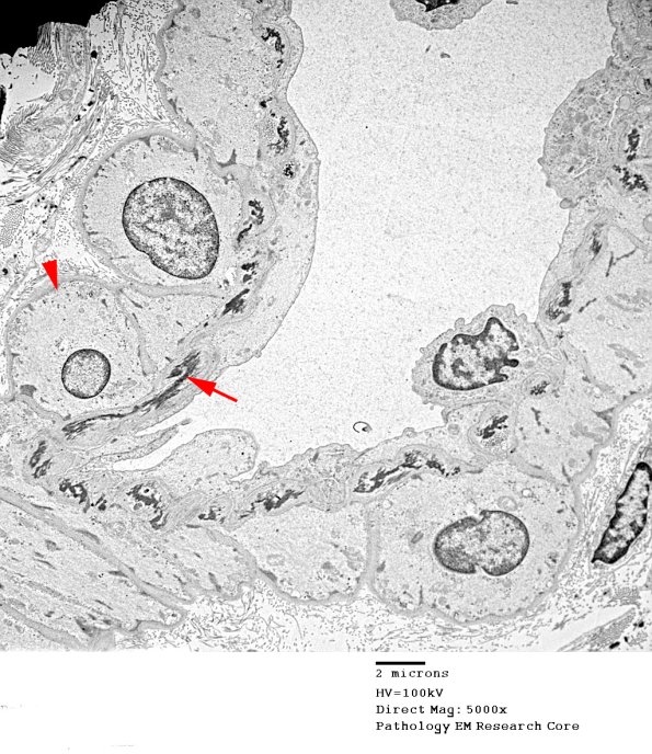1A1 (Case 1) EM016 copy - Copy