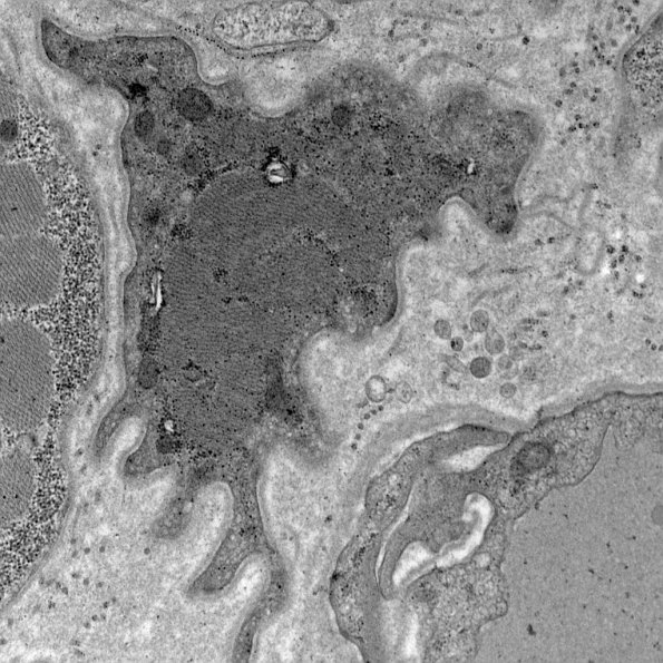 Pathology EM Research Core
02/07/13
16:10
25000
80
100
Imaging
s13-215
Rankin, James K.





XpixCal=197.021
YpixCal=197.021
Unit=micron
##fv3