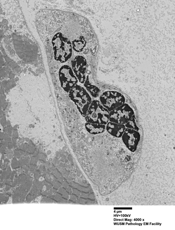 13A1-Case-13-Vas-Lat-Muscle_008.jpg
