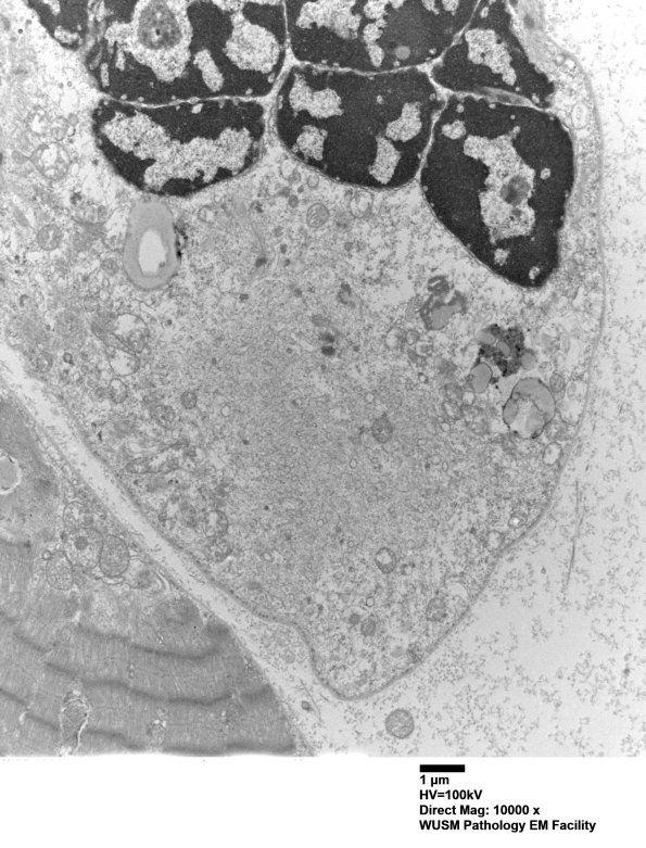 13A2-Case-13-Vas-Lat-Muscle_009.jpg