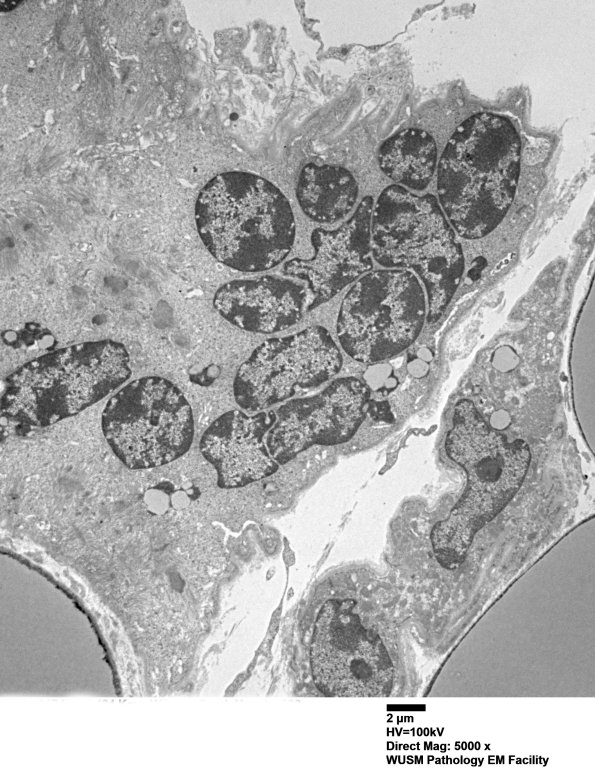 17A2 (Case 17) Quad - Copy