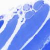 3B1 Atrophy (Case 3) 60X