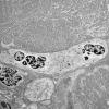 3C1A (Case 3) Muscle_008 - Copy