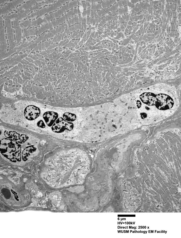 3C1A (Case 3) Muscle_008 - Copy