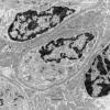 3C2D (Case 3) Muscle_020 - Copy