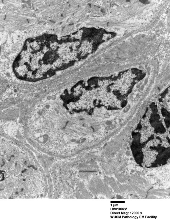 3C2D (Case 3) Muscle_020 - Copy