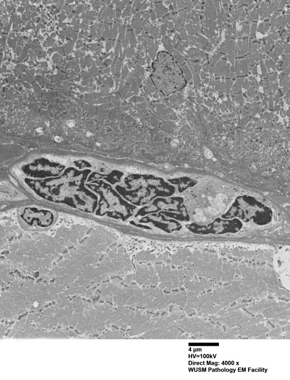 3C3 (Case 3) Muscle_011 - Copy