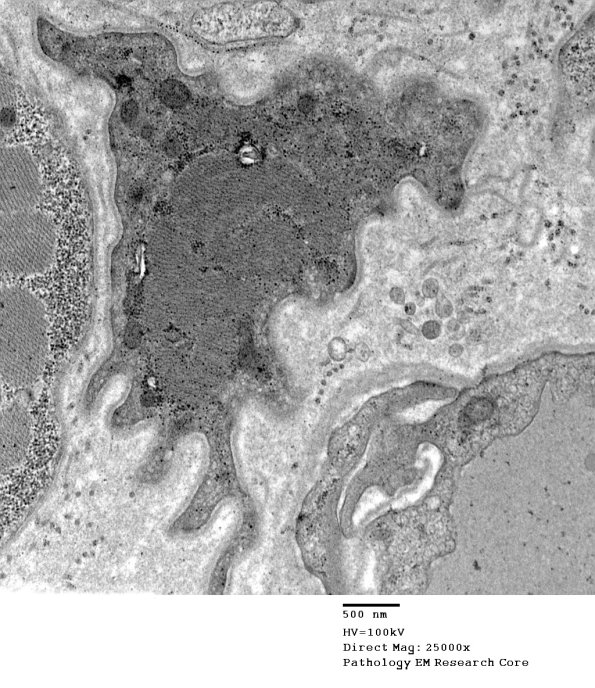 4A2B (Case 4) EM004 - Copy