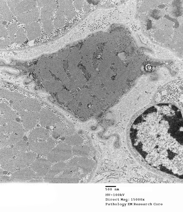 4A2C (Case 4) EM065 - Copy