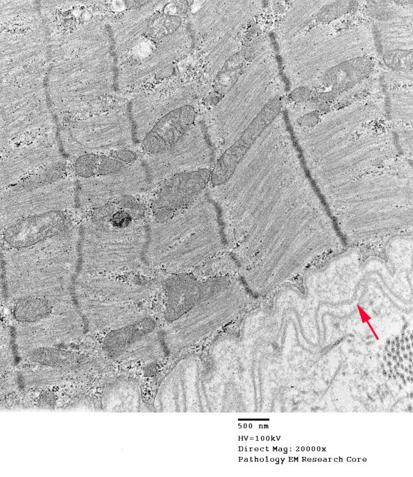 4A3B (Case 4) EM016 copy - Copy