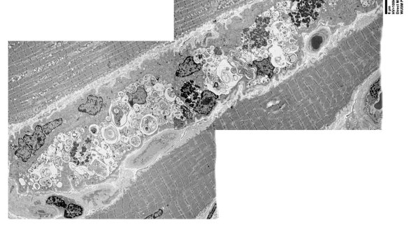 10C1A (Case 10) EM014 - Copy