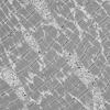 11S1 HCG (Case 11) EM 067 - Copy