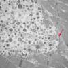 11S2B HCG (Case 11) EM 002 - Copy copy