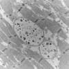 11S2C HCG (Case 11) EM 062 - Copy