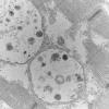 11S2D HCG (Case 11) EM 063 - Copy