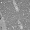 11S3A HCG (Case 11) EM 025 - Copy