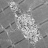 11S4B HCG (Case 11) EM 020 - Copy