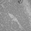 11S5A HCG (Case 11) EM 035 - Copy