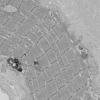 11T10A HCG (Case 11) EM 043 - Copy