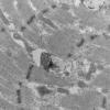 11T12E HCG (Case 11) EM 060 - Copy