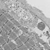 11T13A HCG (Case 11) EM 064 - Copy