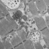 11T1A HCG (Case 11) EM 032 - Copy