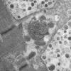 11T3B HCG (Case 11) EM 027 - Copy