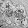 11T4C HCG (Case 11) EM 016 - Copy