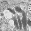 11U1B HCG (Case 11) EM 047 - Copy