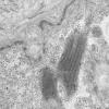 11U1C HCG (Case 11) EM 048 - Copy