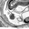 1B4 (Case 1) EM079 - Copy